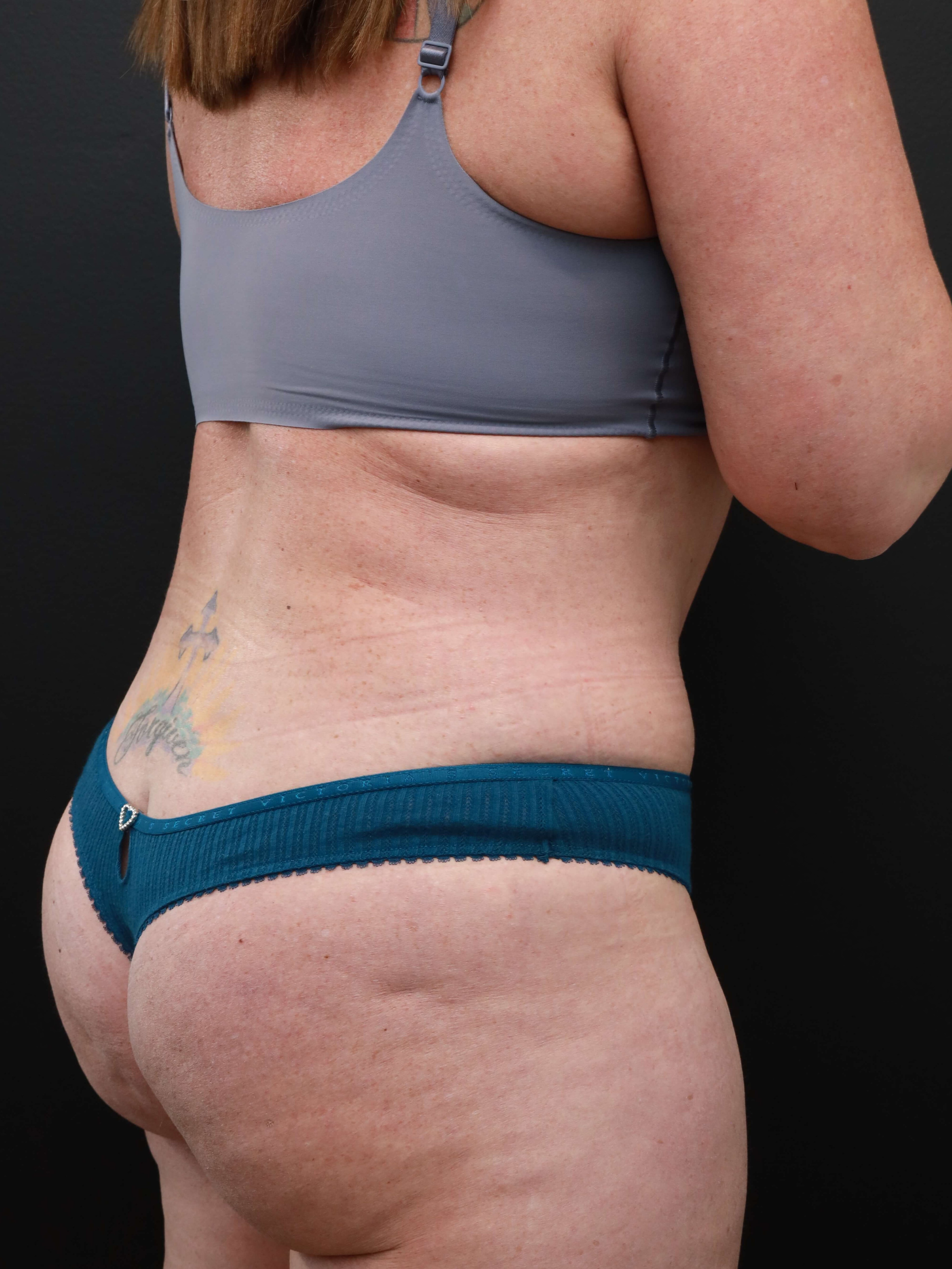 Right Back Oblique After