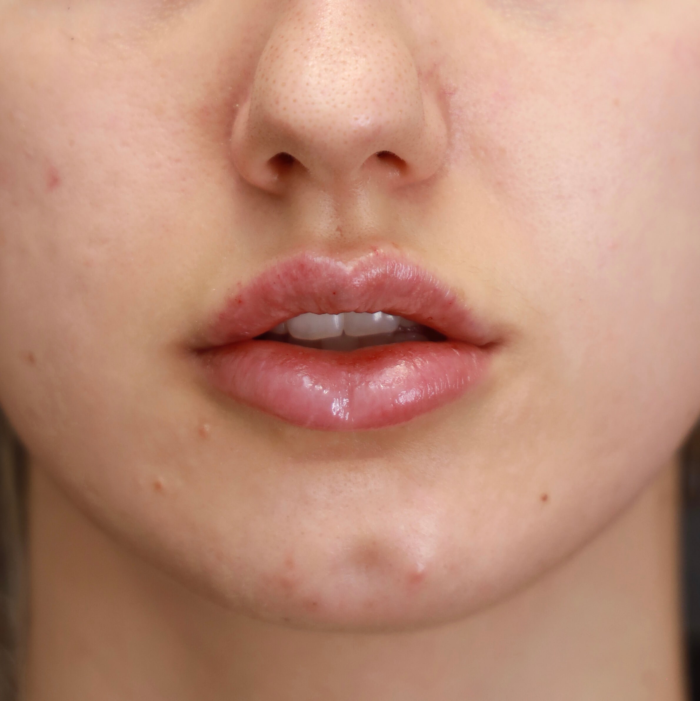AP lips parted After