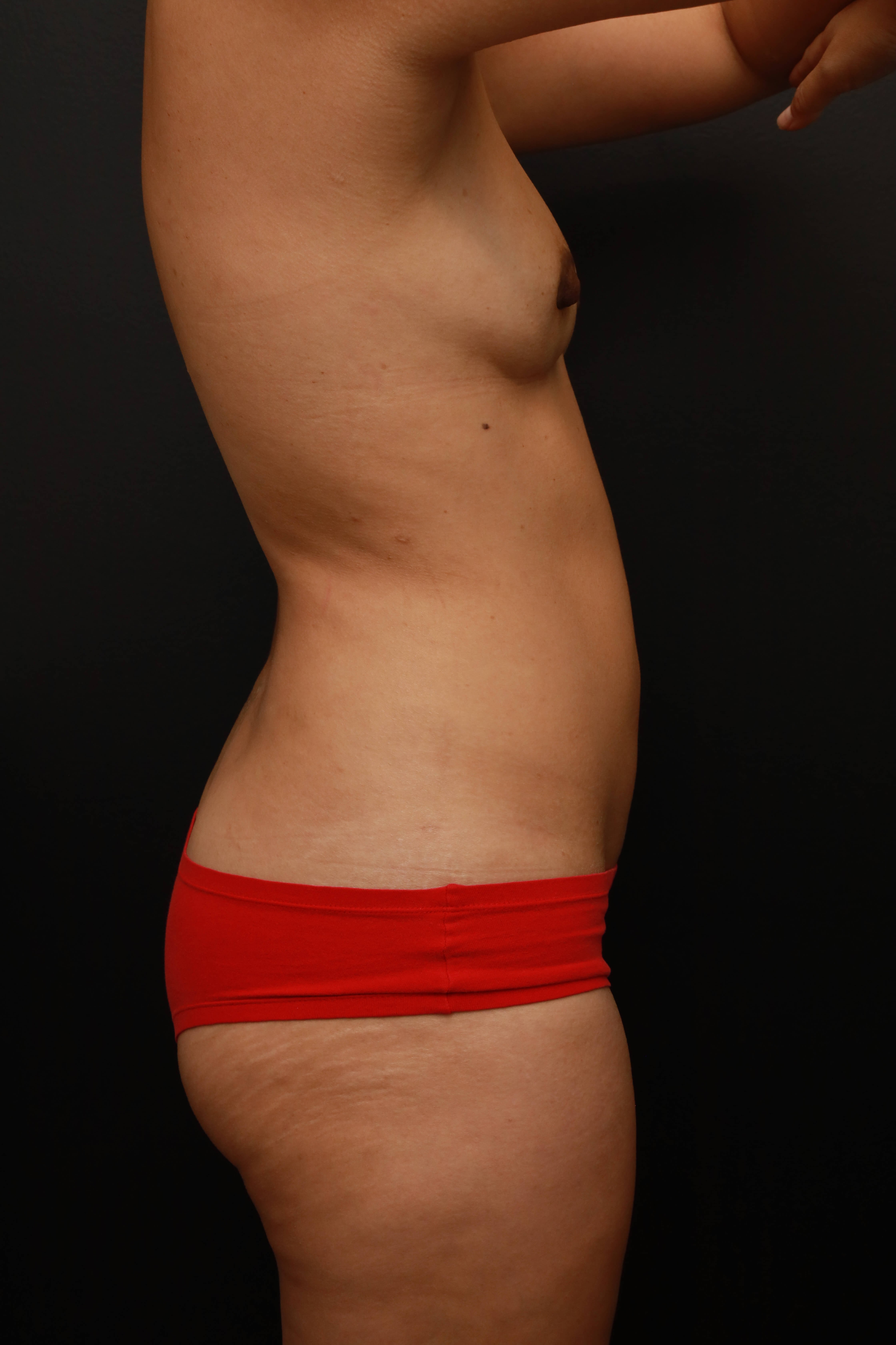 Right Lateral Before