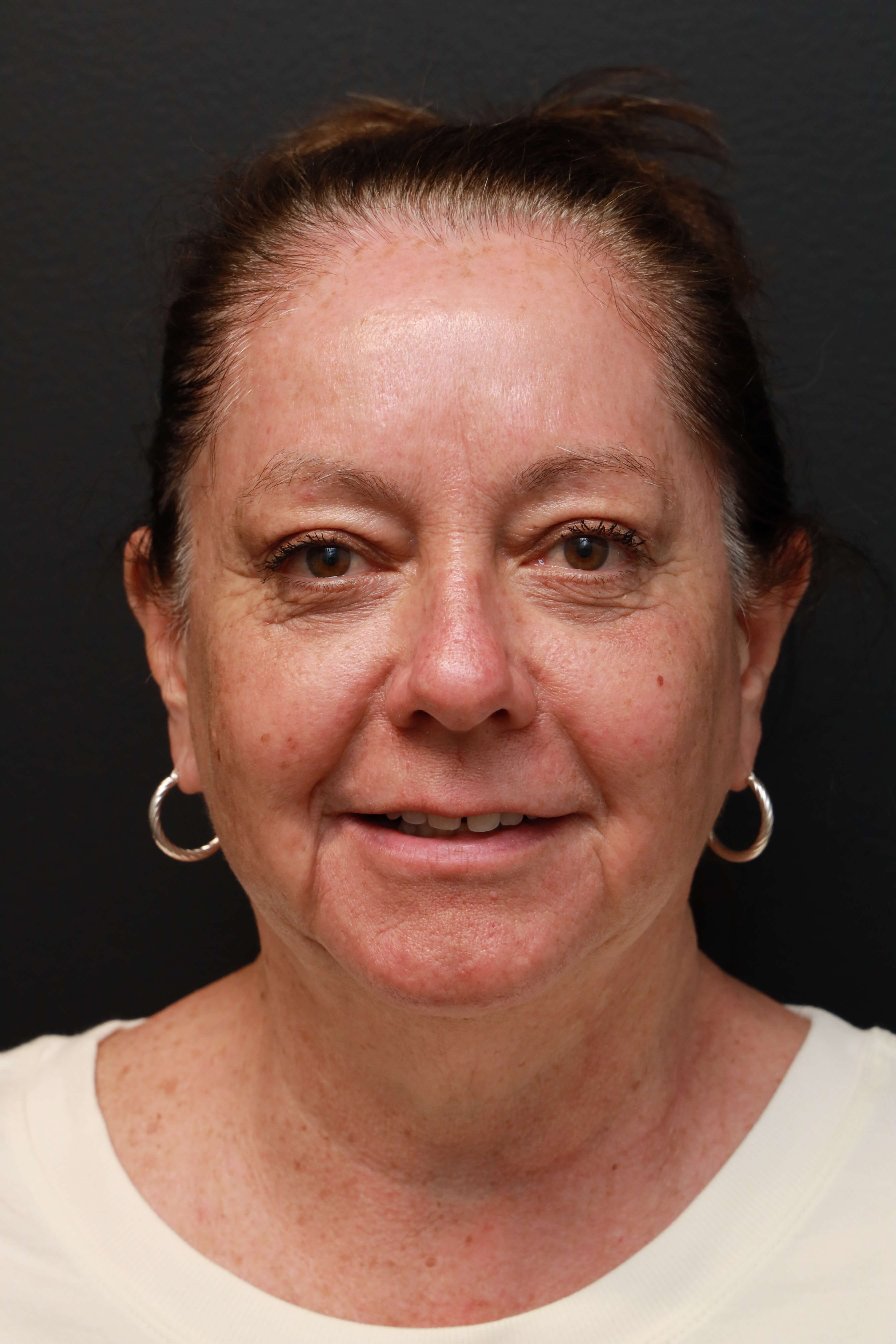 After Image