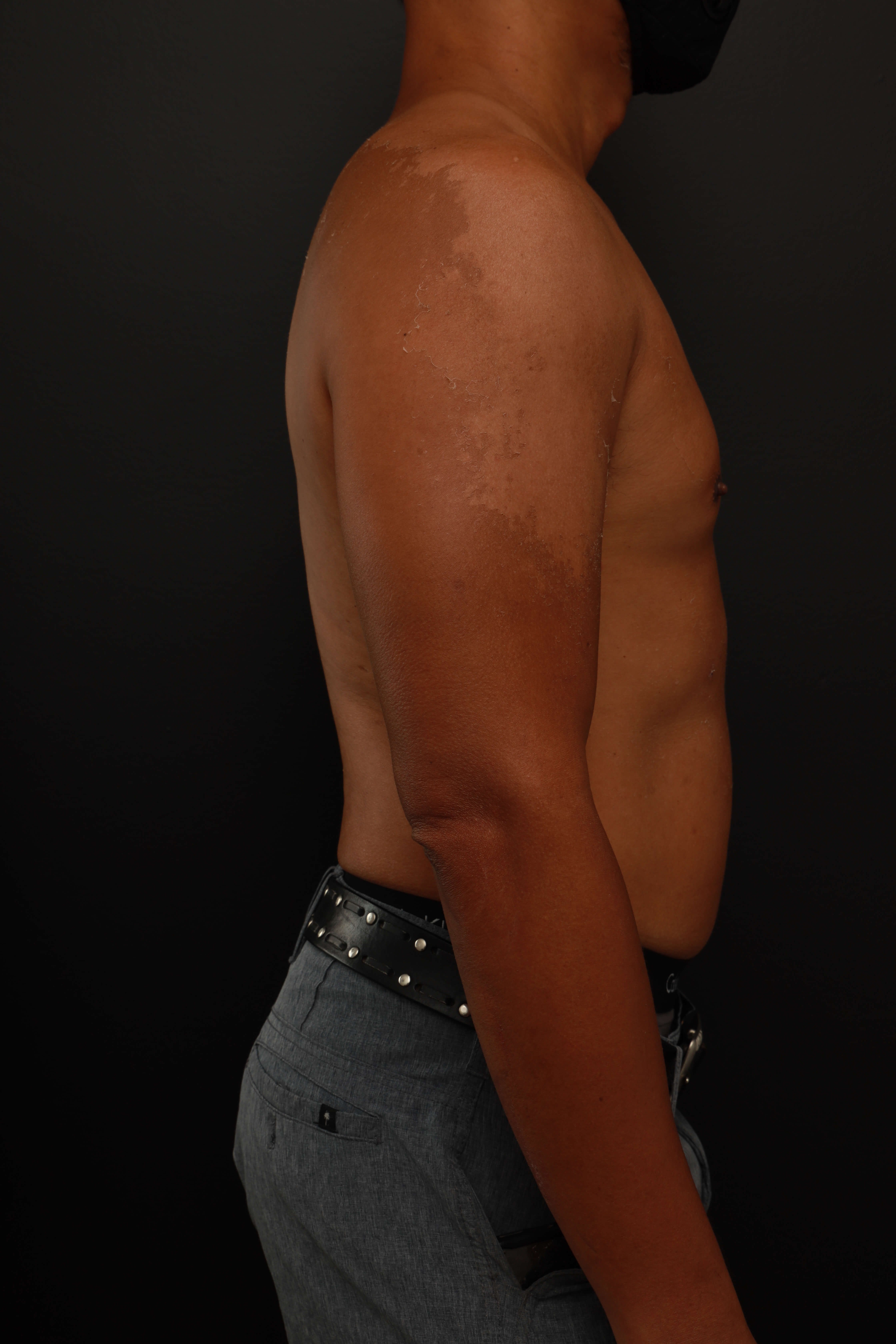 Right Lateral Before