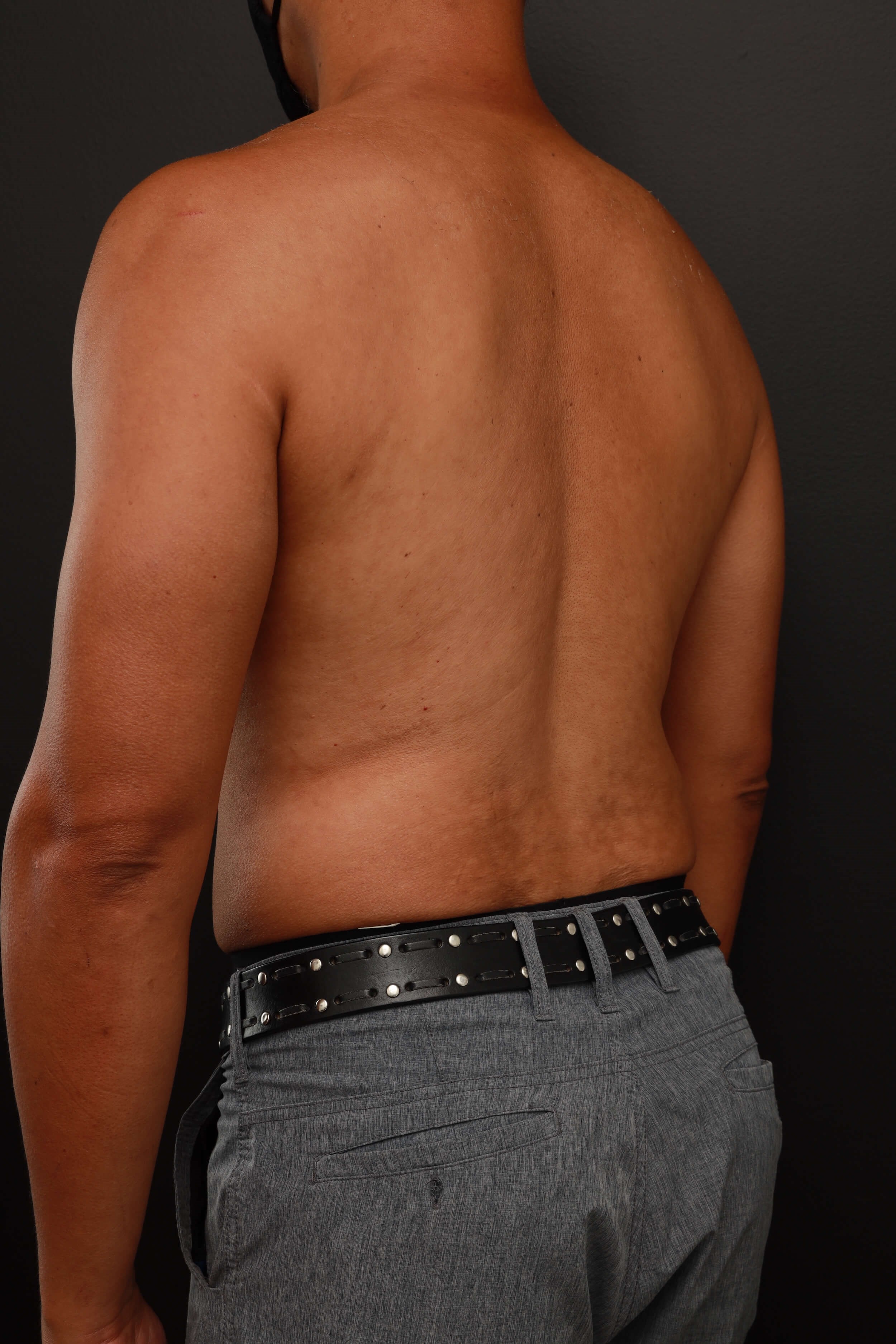 Left Back Oblique Before