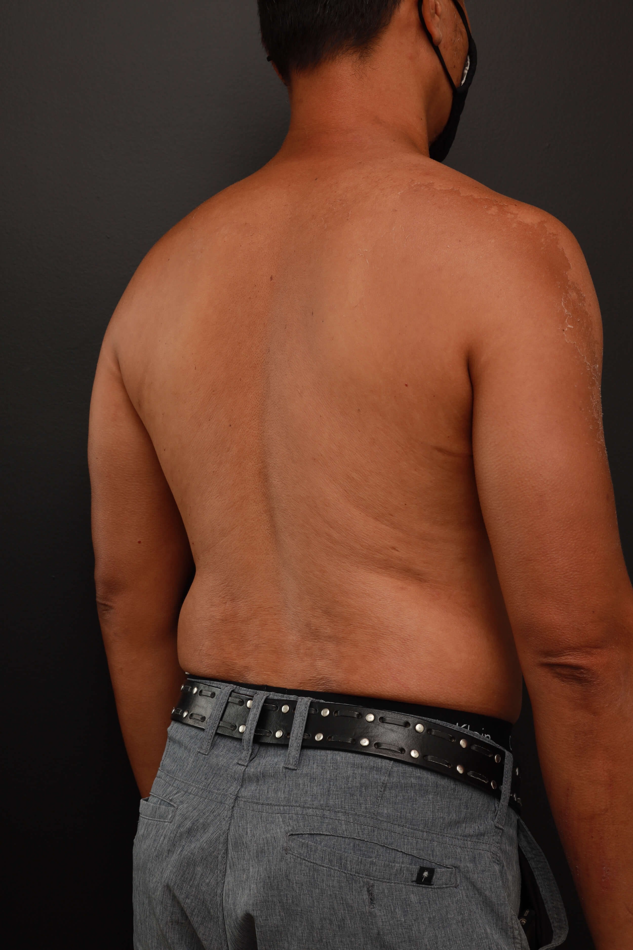 Right Back Oblique Before