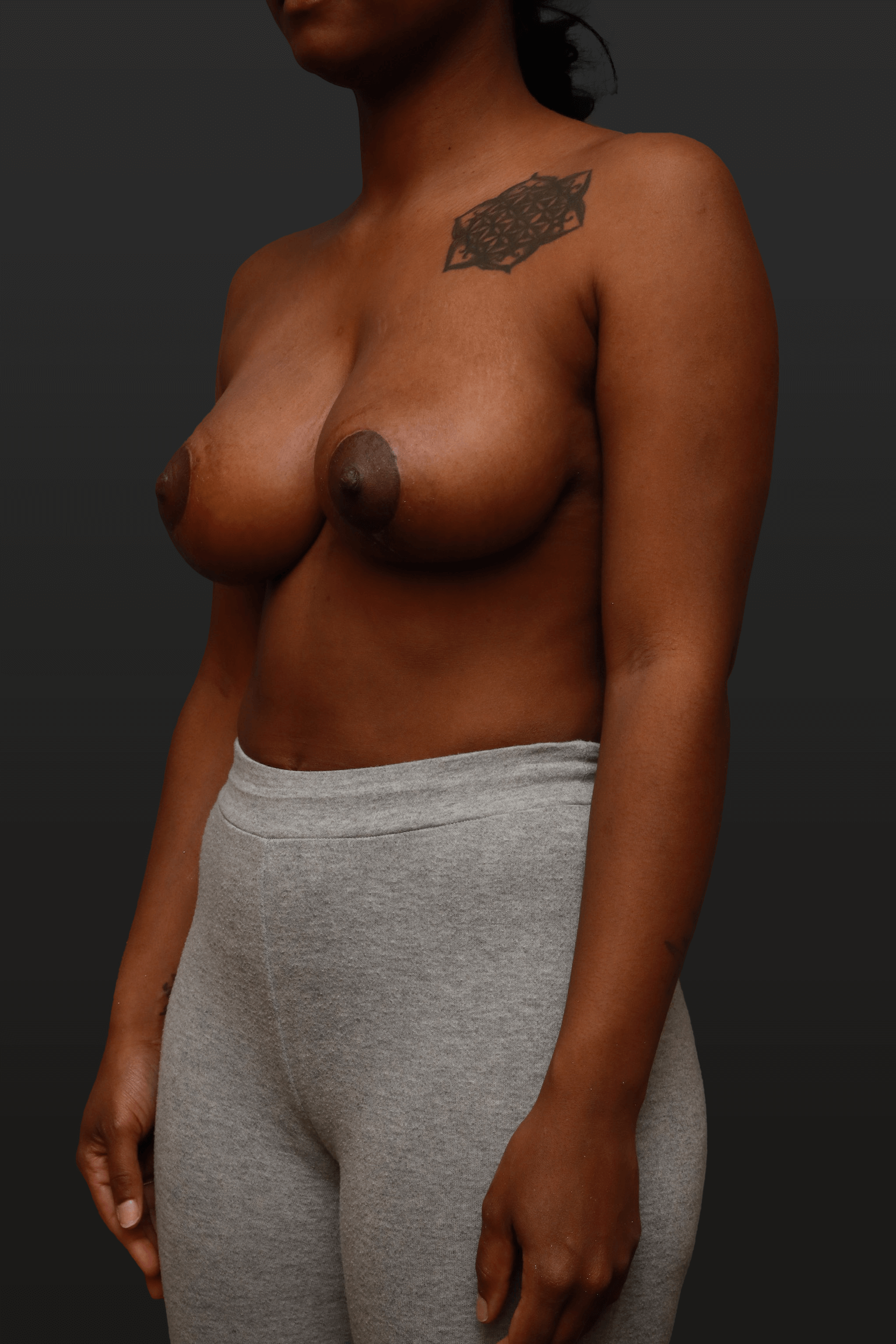 Left Oblique After