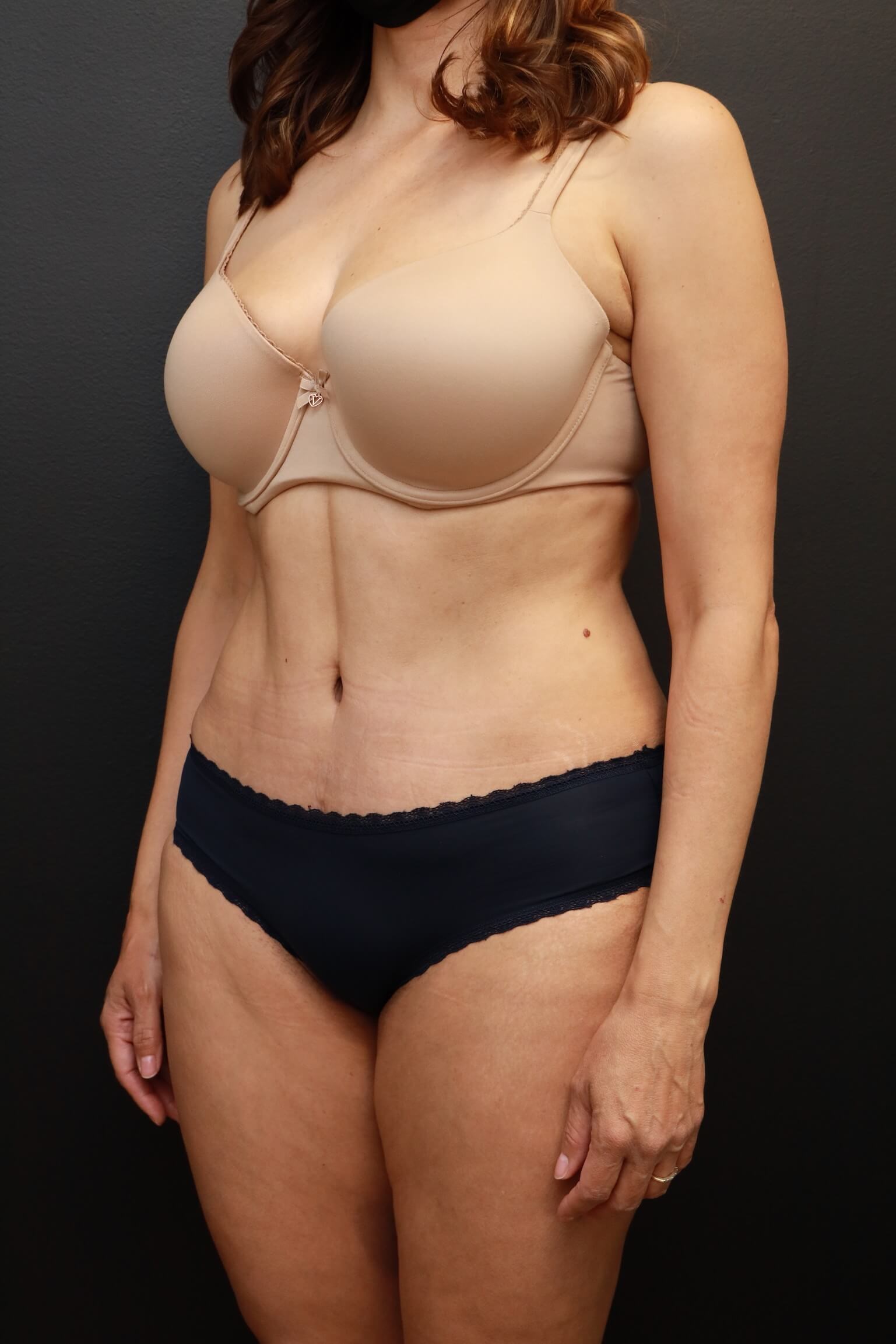 Left Oblique After