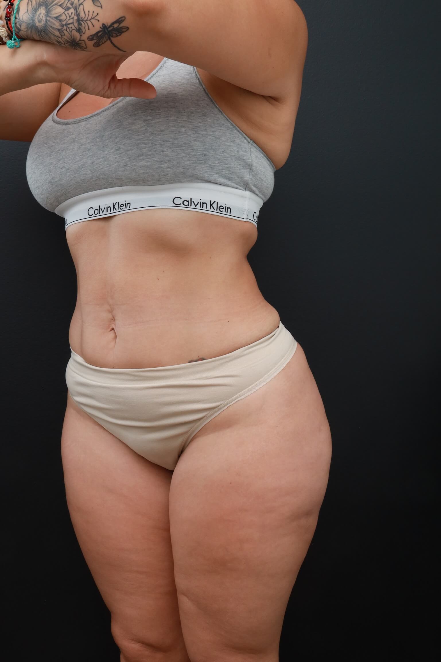 Left Oblique After