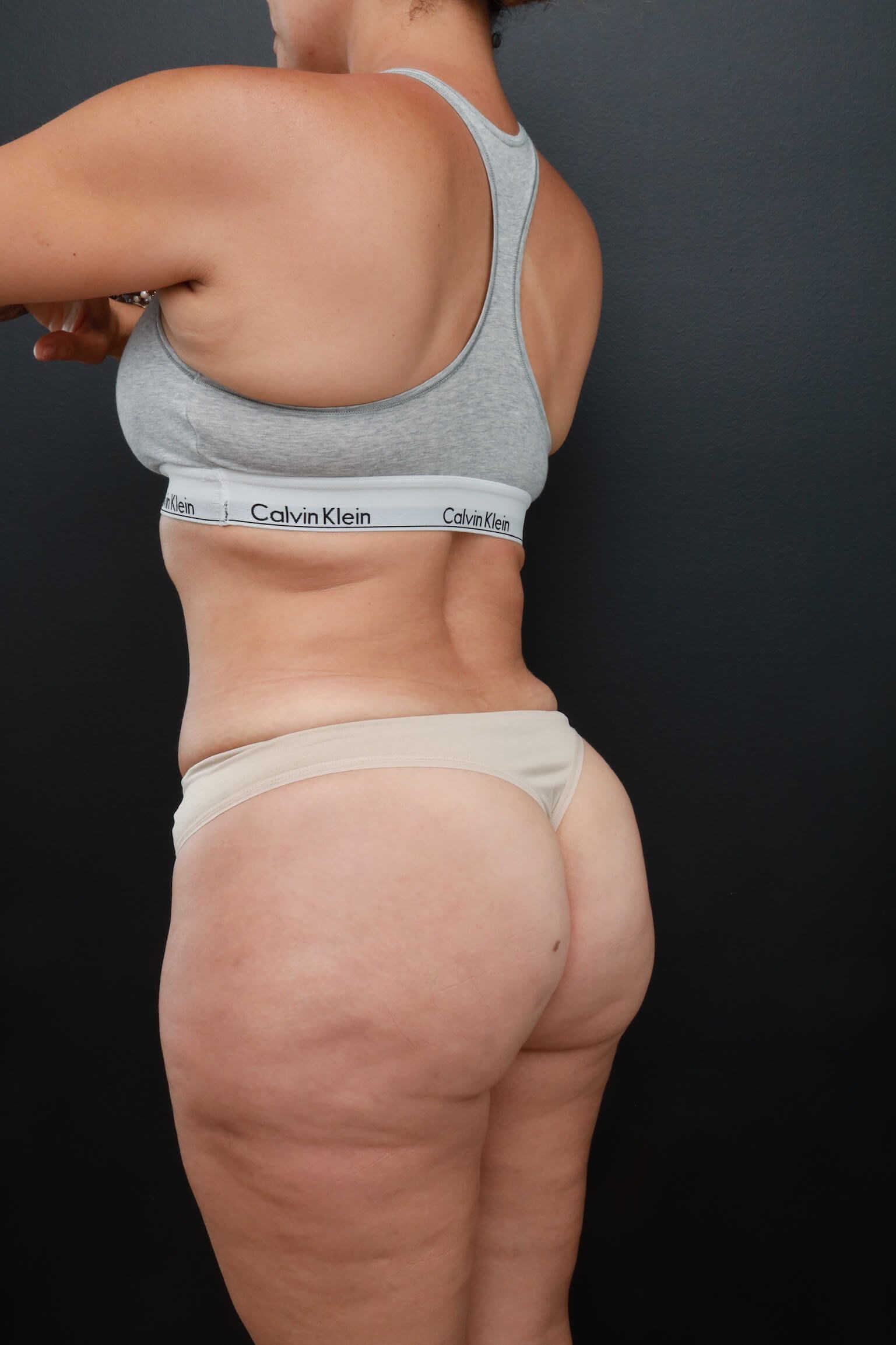 Left Back Oblique After