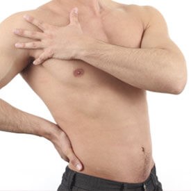 Gynecomastia 
